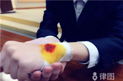 工伤十级伤残怎样赔偿