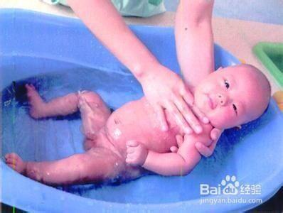 夏季要及时防止痱子