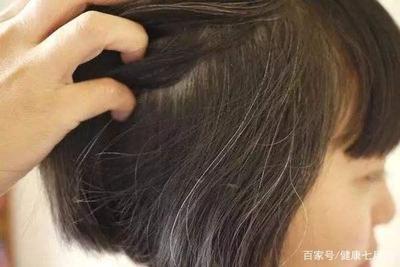 三月生：白头发到底能不能拔