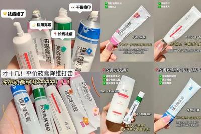 祛痘用什么药膏效果最好