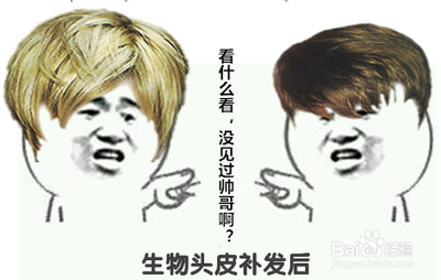 织发补发的胶粘方式和卡扣方式哪种好？