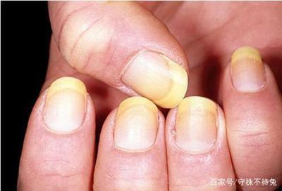 怎样从书中或纸质文件中去除烟味 怎样从书中或纸质文件中去除烟味