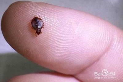 跳蚤咬了怎么止痒最快