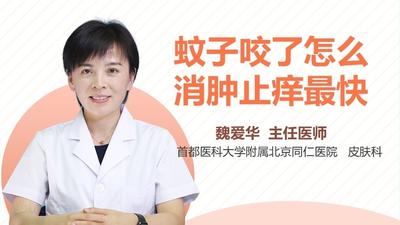 蚊子咬了怎么消肿止痒最快 蚊子咬了擦什么药膏