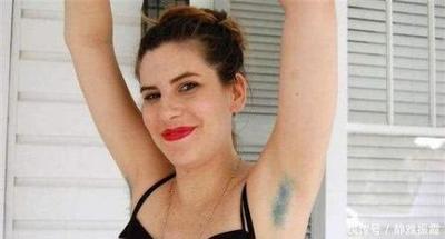 为什么我13岁腋下长毛了还有狐臭？13岁长腋毛有狐臭怎么办？