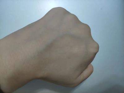 男性青筋凸起要注意 是个慢性炸弹