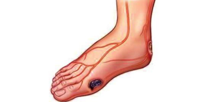 什么是鹿茸呢 鹿茸有什么功效呢