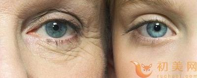 眼部细纹是岁月的痕迹还是护肤的挑战