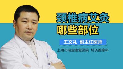 颈椎病艾灸做哪些部位 艾灸颈椎灸哪里