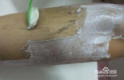 脱毛膏真的有用吗 脱毛膏是干着用还是湿着用 脱毛膏真的有用吗 脱毛膏是干着用还是湿着用