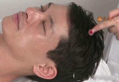 承光的准确位置图 承光的功效与作用 承光的准确位置图 承光的功效与作用